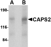 CAPS2 Antibody - Western blot of CAPS2 in human brain tissue lysate with CAPS2 antibody at (A) 0.5 and (B) 1 ug/ml.