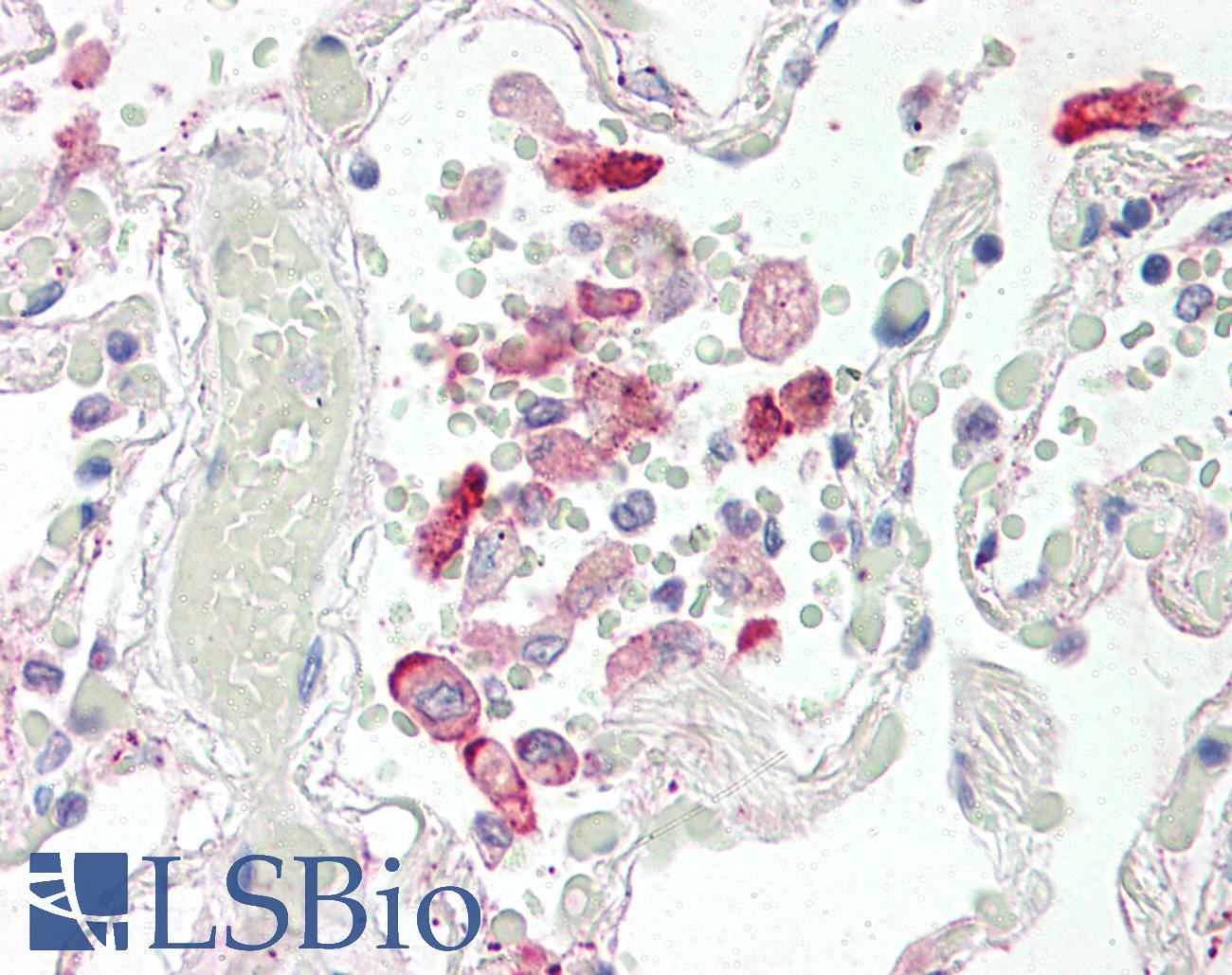 Carboxylesterase 1 / CES1 Antibody - Anti-CES1 antibody IHC of human lung. Immunohistochemistry of formalin-fixed, paraffin-embedded tissue after heat-induced antigen retrieval. Antibody concentration 5 ug/ml.