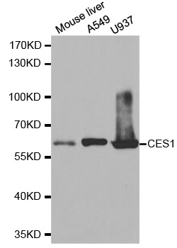 Carboxylesterase 1 / CES1 Antibody - Western blot analysis of extracts of various cell lines, using CES1 antibody.