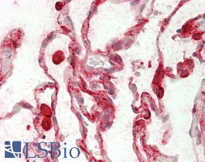 Carboxylesterase 1 / CES1 Antibody - Human Lung: Formalin-Fixed, Paraffin-Embedded (FFPE)