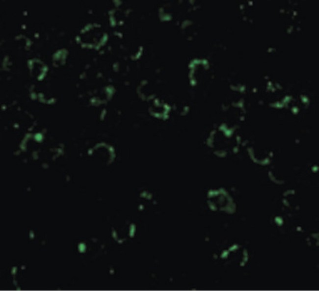 CARD10 / CARMA3 Antibody - Immunofluorescence of CARD10 in EL4 cells with CARD10 antibody at 20 ug/ml.