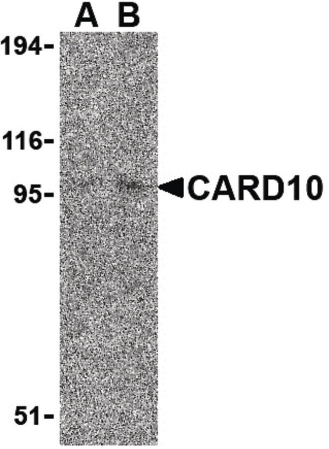 CARD10 / CARMA3 Antibody - Western blot of CARD10 expression in EL4 cell lysate with CARD10 antibody at (A) 5 and (B) 10 ug /ml.