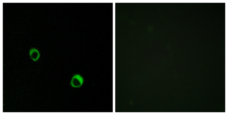 CARD14 Antibody - Immunofluorescence analysis of MCF7 cells, using CAR14 Antibody. The picture on the right is blocked with the synthesized peptide.