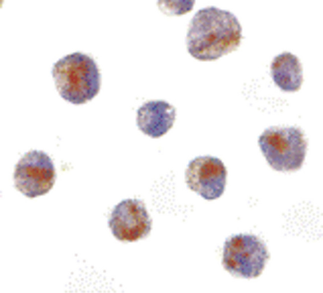 CARD8 / Cardinal / TUCAN Antibody - Immunocytochemistry of CARD8 in K562 cells with CARD8 antibody at 10 ug/ml.