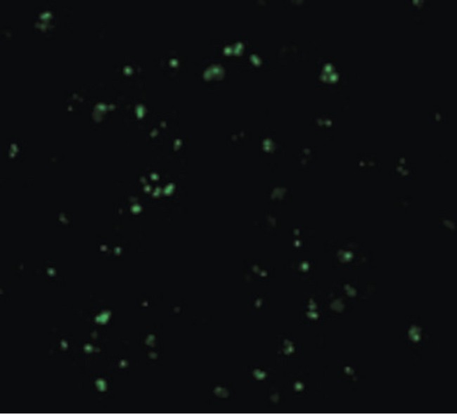 CARD8 / Cardinal / TUCAN Antibody - Immunofluorescence of CARD8 in K562 cells with CARD8 antibody at 20 ug/ml.