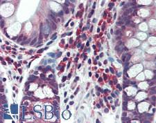 CARMA1 / CARD11 Antibody - Human Small Intestine: Formalin-Fixed, Paraffin-Embedded (FFPE)