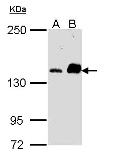 CARMA1 / CARD11 Antibody - Sample (30 ug of whole cell lysate). A: A431. B: Raji. 5% SDS PAGE. CARD11 antibody diluted at 1:1000. 