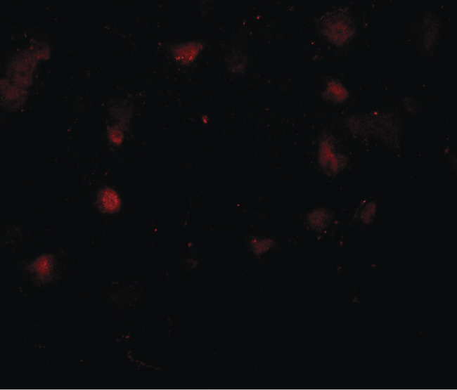 CASK Antibody - Immunofluorescence of CASK in human brain tissue with CASK antibody at 20 ug/ml.