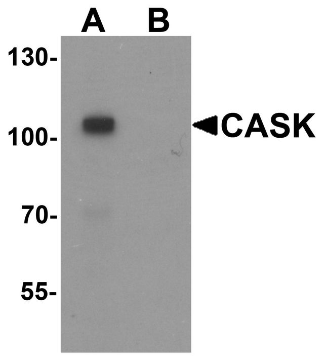CASK Antibody - Western blot analysis of CASK in mouse brain tissue lysate with CASK antibody at 1 ug/ml in (A) the absence and (B) the presence of blocking peptide.