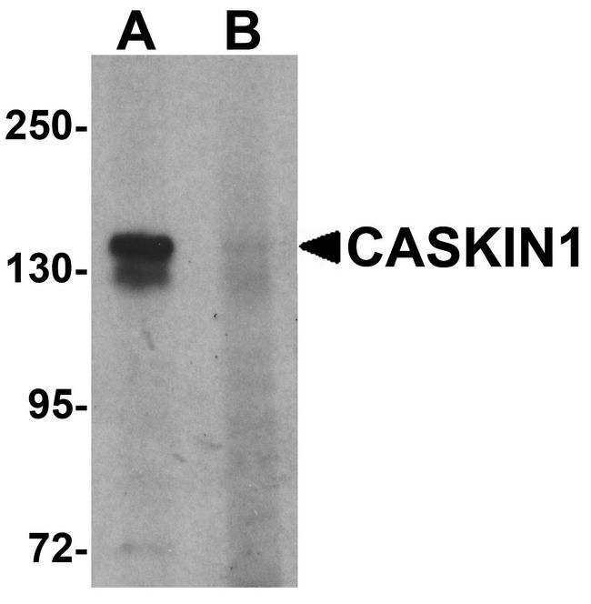 CASKIN1 Antibody - Western blot analysis of CASKIN1 in HeLa cell lysate with CASKIN1 antibody at 1 ug/ml in (A) the absence and (B) the presence of blocking peptide.