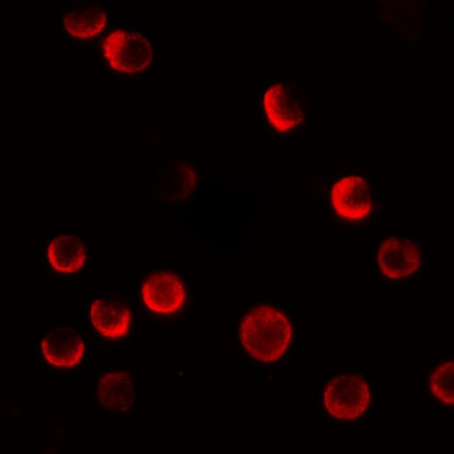CASKIN2 Antibody - Immunofluorescence of CASKIN2 in HeLa cells with CASKIN2 antibody at 20 µg/mL.
