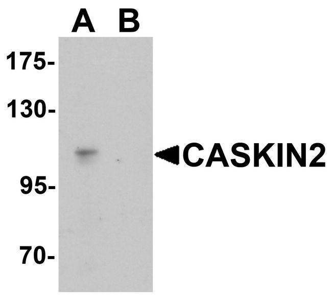 CASKIN2 Antibody - Western blot analysis of CASKIN2 in HeLa cell lysate with CASKIN2 antibody at 1 ug/ml in (A) the absence and (B) the presence of blocking peptide.