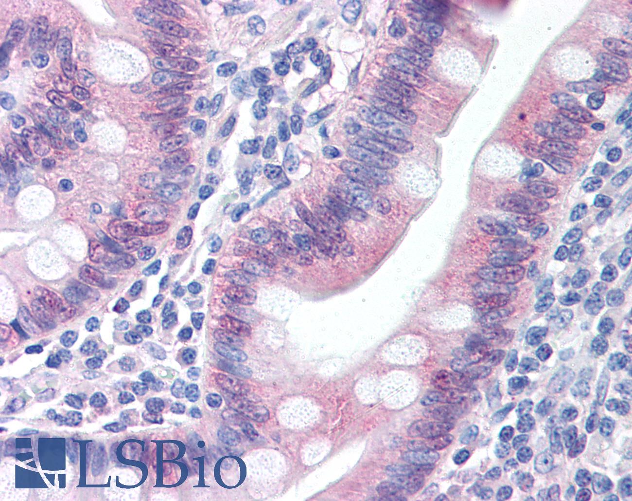 CASP1 / Caspase 1 Antibody - Anti-Caspase 1 antibody IHC of human small intestine. Immunohistochemistry of formalin-fixed, paraffin-embedded tissue after heat-induced antigen retrieval. Antibody concentration 20 ug/ml.