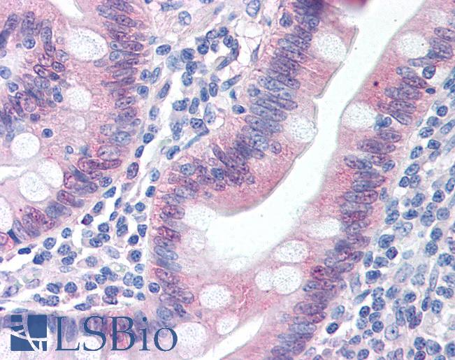 CASP1 / Caspase 1 Antibody - Anti-Caspase 1 antibody IHC of human small intestine. Immunohistochemistry of formalin-fixed, paraffin-embedded tissue after heat-induced antigen retrieval. Antibody concentration 20 ug/ml.