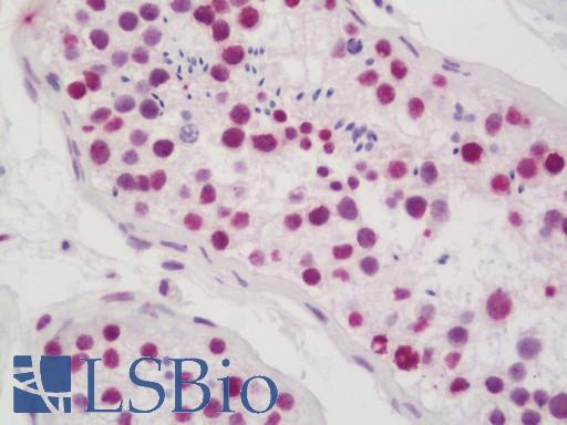 CASP1 / Caspase 1 Antibody - Anti-CASP1 / Caspase 1 antibody IHC staining of human testis. Immunohistochemistry of formalin-fixed, paraffin-embedded tissue after heat-induced antigen retrieval. Antibody dilution 1:100. 