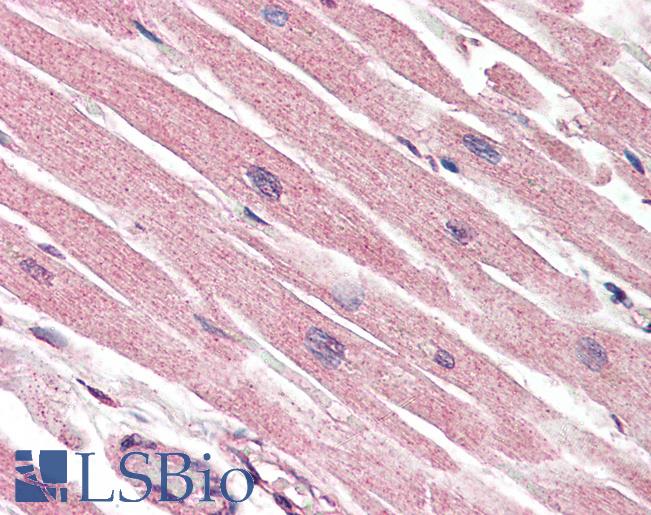 CASP1 / Caspase 1 Antibody - Anti-Caspase 1 antibody IHC of human heart. Immunohistochemistry of formalin-fixed, paraffin-embedded tissue after heat-induced antigen retrieval. Antibody concentration 5 ug/ml.