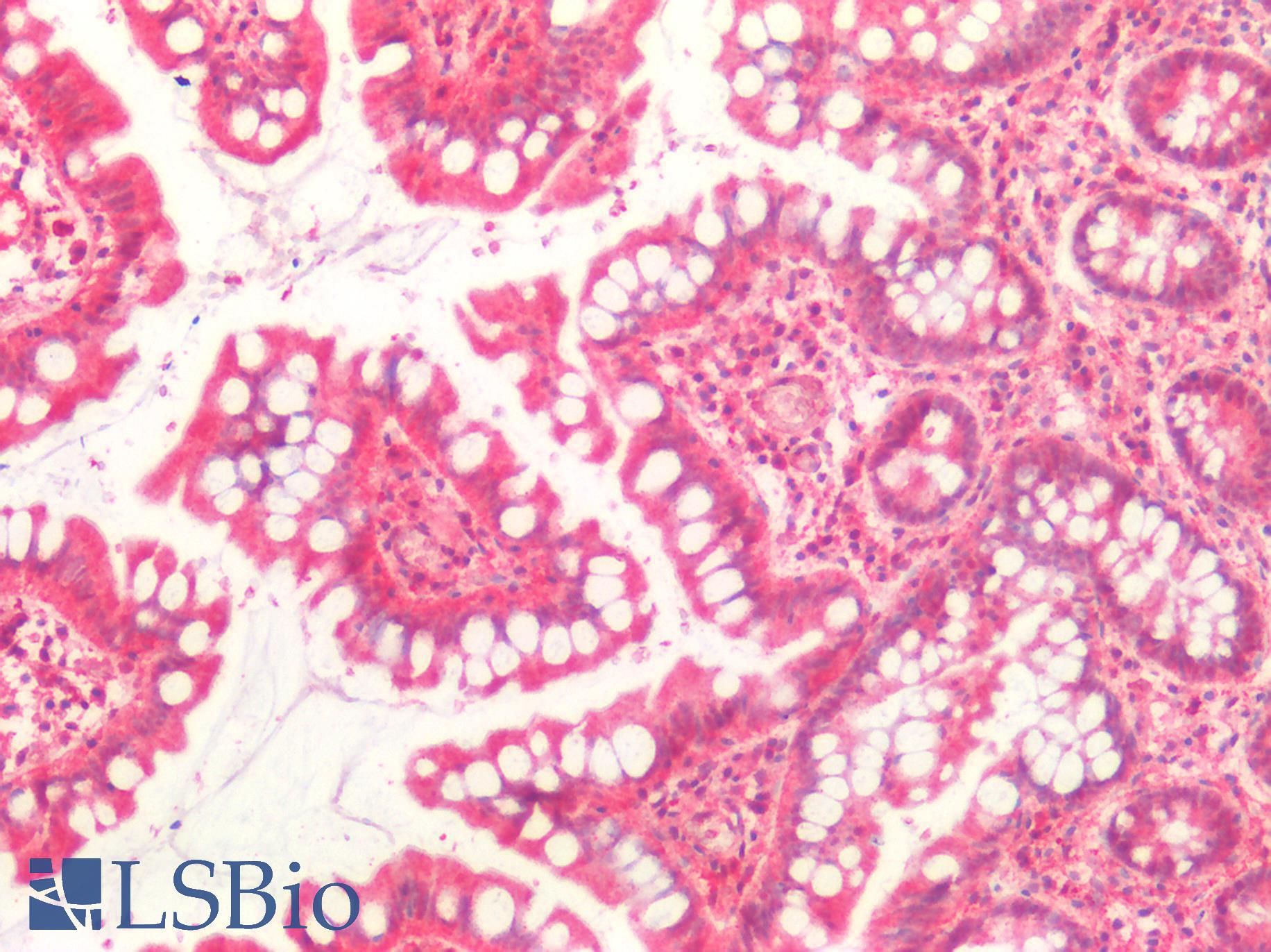 CASP10 / Caspase 10 Antibody - Human Small Intestine: Formalin-Fixed, Paraffin-Embedded (FFPE)