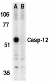 CASP12 / Caspase 12 Antibody - Western blot of caspase-12 in murine brain tissue lysate in the absence (A) or presence (B) of blocking peptide with Caspase-12 antibody at 1 ug/ml.