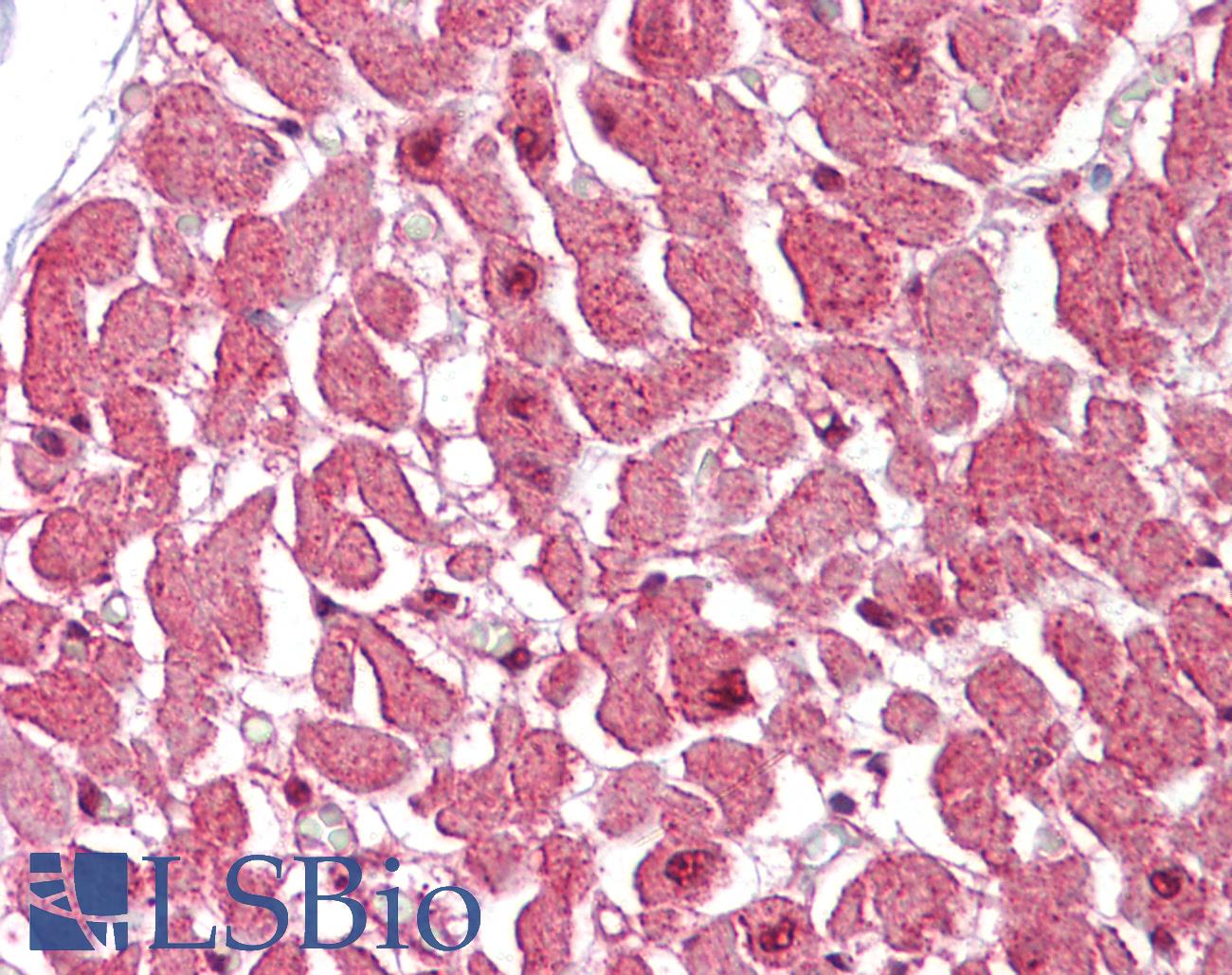 CASP12 / Caspase 12 Antibody - Anti-CASP12 / Caspase 12 antibody IHC of human heart. Immunohistochemistry of formalin-fixed, paraffin-embedded tissue after heat-induced antigen retrieval. Antibody concentration 2.5 ug/ml.