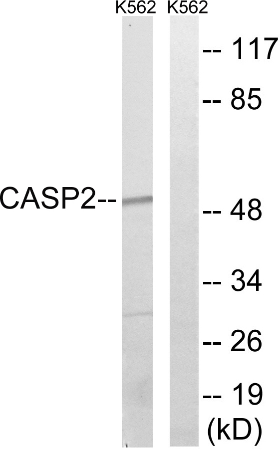 CASP2 / Caspase 2 Antibody - Western blot analysis of lysates from K562, using Caspase 2 Antibody. The lane on the right is blocked with the synthesized peptide.