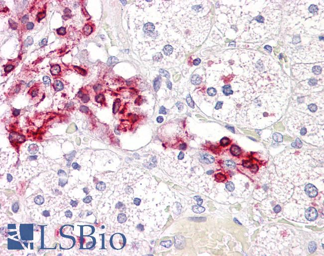 CASP2 / Caspase 2 Antibody - Anti-CASP2 / Caspase 2 antibody IHC of human adrenal. Immunohistochemistry of formalin-fixed, paraffin-embedded tissue after heat-induced antigen retrieval. Antibody dilution 1:100.