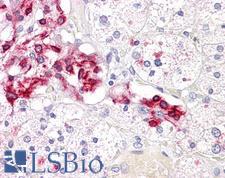 CASP2 / Caspase 2 Antibody - Anti-CASP2 / Caspase 2 antibody IHC of human adrenal. Immunohistochemistry of formalin-fixed, paraffin-embedded tissue after heat-induced antigen retrieval. Antibody dilution 1:100.