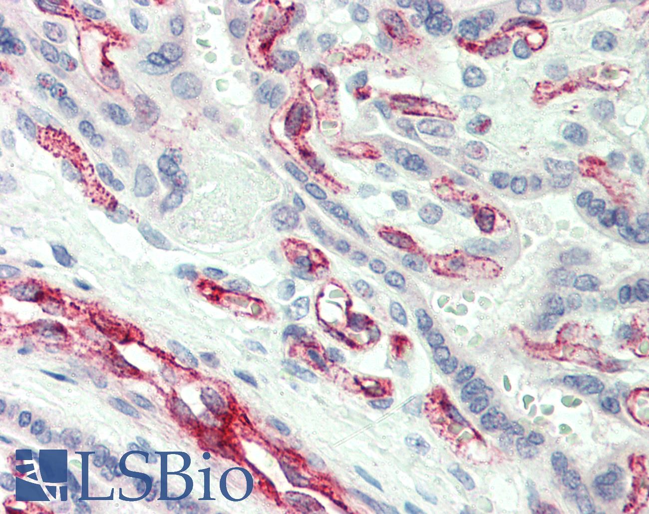 CASP2 / Caspase 2 Antibody - Anti-CASP2 / Caspase 2 antibody IHC of human placenta. Immunohistochemistry of formalin-fixed, paraffin-embedded tissue after heat-induced antigen retrieval. Antibody concentration 10 ug/ml.