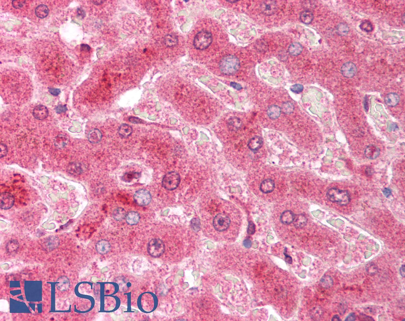 CASP3 / Caspase 3 Antibody - Anti-Caspase 3 antibody IHC of human liver. Immunohistochemistry of formalin-fixed, paraffin-embedded tissue after heat-induced antigen retrieval. Antibody concentration 10 ug/ml.