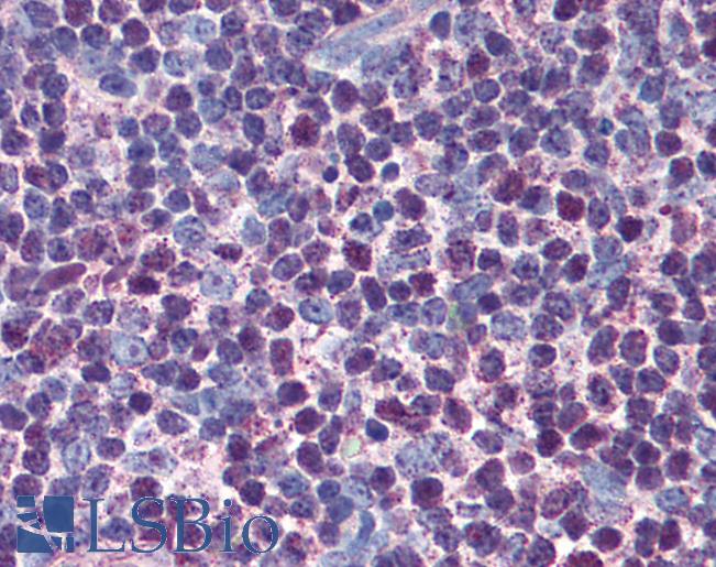 CASP3 / Caspase 3 Antibody - Anti-Caspase 3 antibody IHC of human thymus. Immunohistochemistry of formalin-fixed, paraffin-embedded tissue after heat-induced antigen retrieval. Antibody concentration 5 ug/ml.