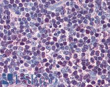 CASP3 / Caspase 3 Antibody - Anti-Caspase 3 antibody IHC of human thymus. Immunohistochemistry of formalin-fixed, paraffin-embedded tissue after heat-induced antigen retrieval. Antibody concentration 5 ug/ml.