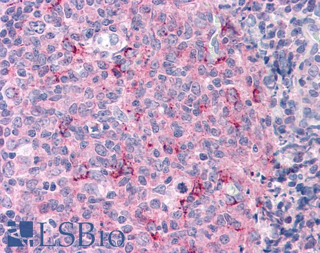 CASP3 / Caspase 3 Antibody - Anti-Caspase 3 antibody IHC of human tonsil. Immunohistochemistry of formalin-fixed, paraffin-embedded tissue after heat-induced antigen retrieval. Antibody concentration 5 ug/ml.