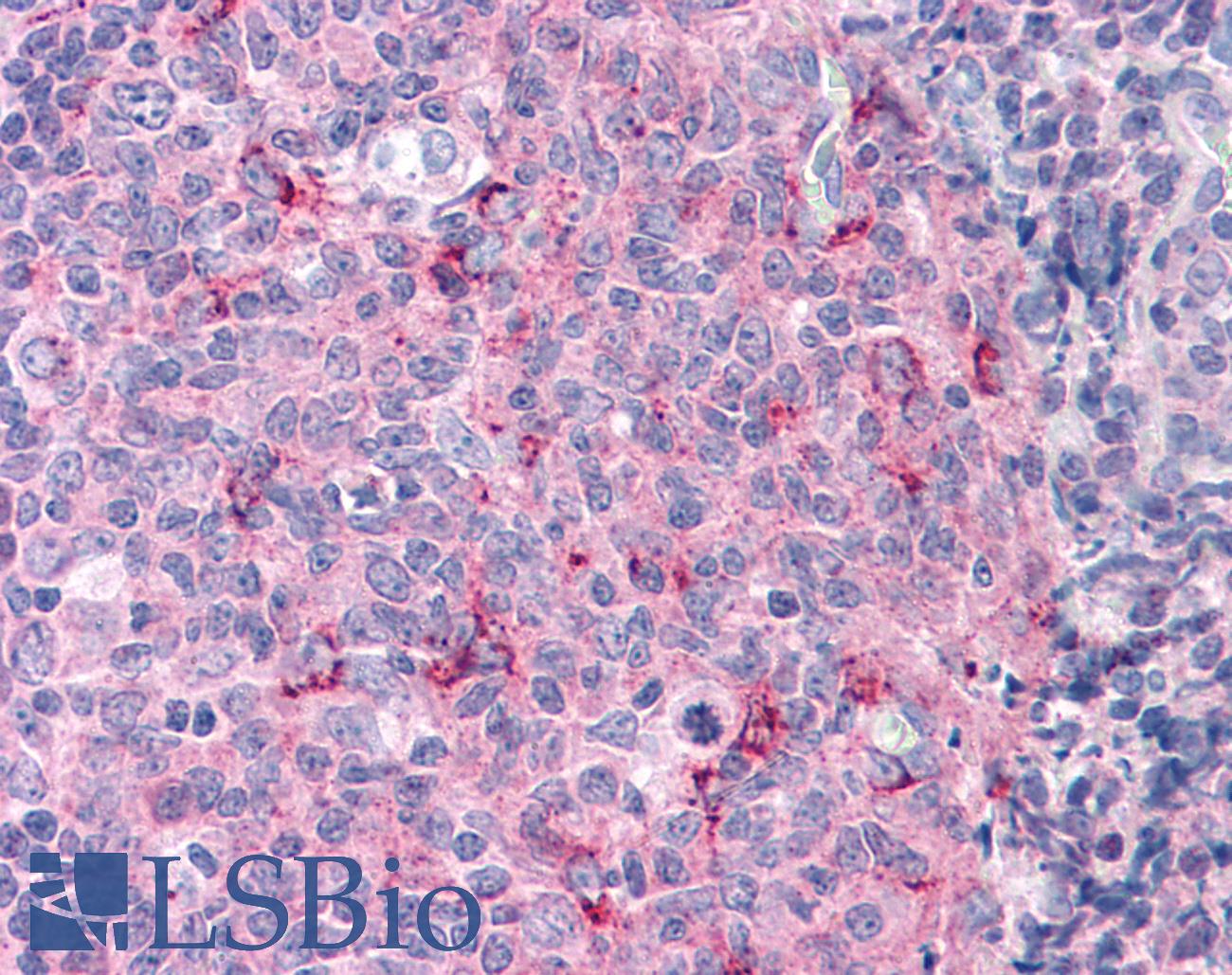 CASP3 / Caspase 3 Antibody - Anti-Caspase 3 antibody IHC of human tonsil. Immunohistochemistry of formalin-fixed, paraffin-embedded tissue after heat-induced antigen retrieval. Antibody concentration 5 ug/ml.