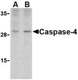 CASP4 / Caspase 4 Antibody - Western blot of caspase-4 in human spleen cells with caspase-4 antibody at (A) 1 and (B) 2 ug/ml.
