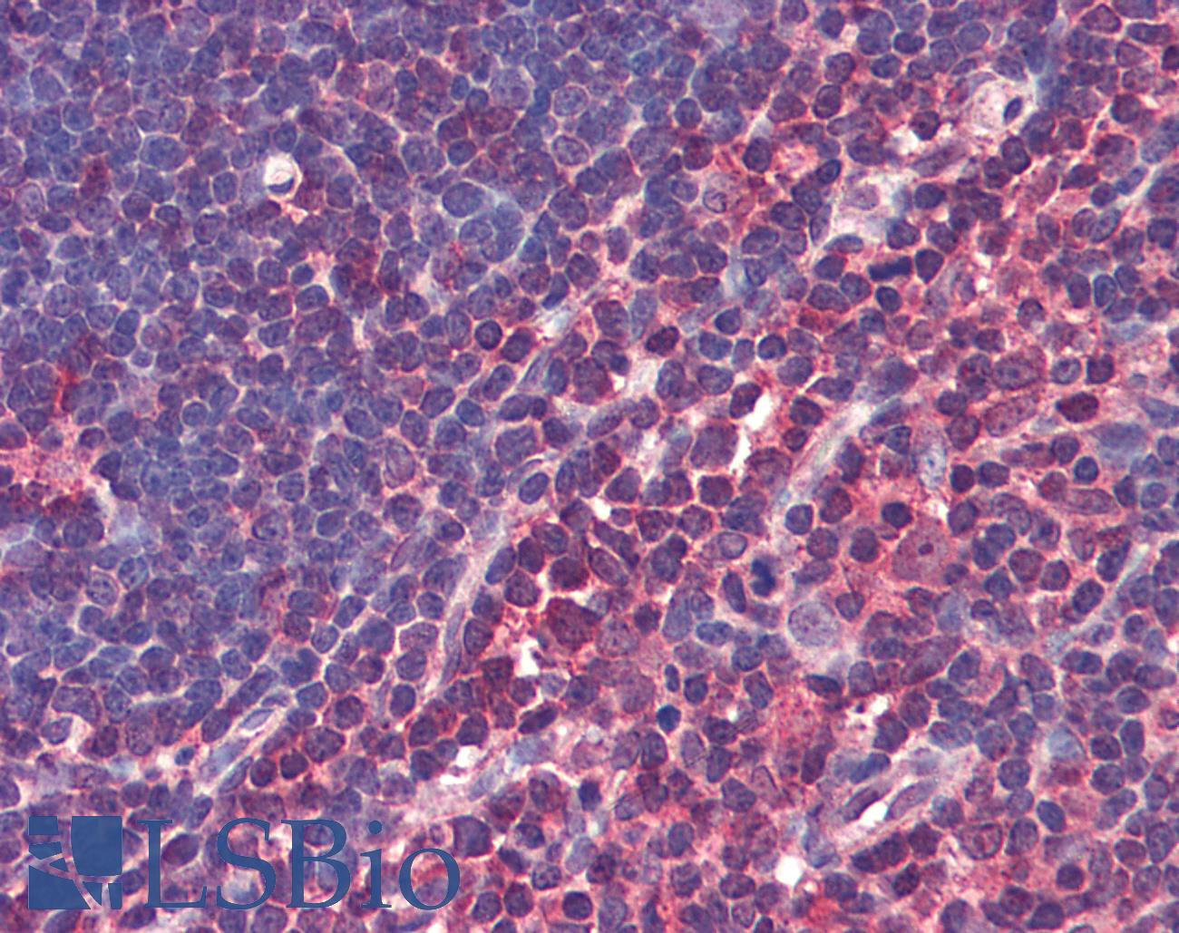 CASP4 / Caspase 4 Antibody - Anti-CASP4 / Caspase 4 antibody IHC of human thymus. Immunohistochemistry of formalin-fixed, paraffin-embedded tissue after heat-induced antigen retrieval. Antibody concentration 5 ug/ml.