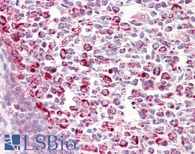 CASP6 / Caspase 6 Antibody - Anti-Caspase 6 antibody IHC of human tonsil. Immunohistochemistry of formalin-fixed, paraffin-embedded tissue after heat-induced antigen retrieval. Antibody dilution 10 ug/ml.