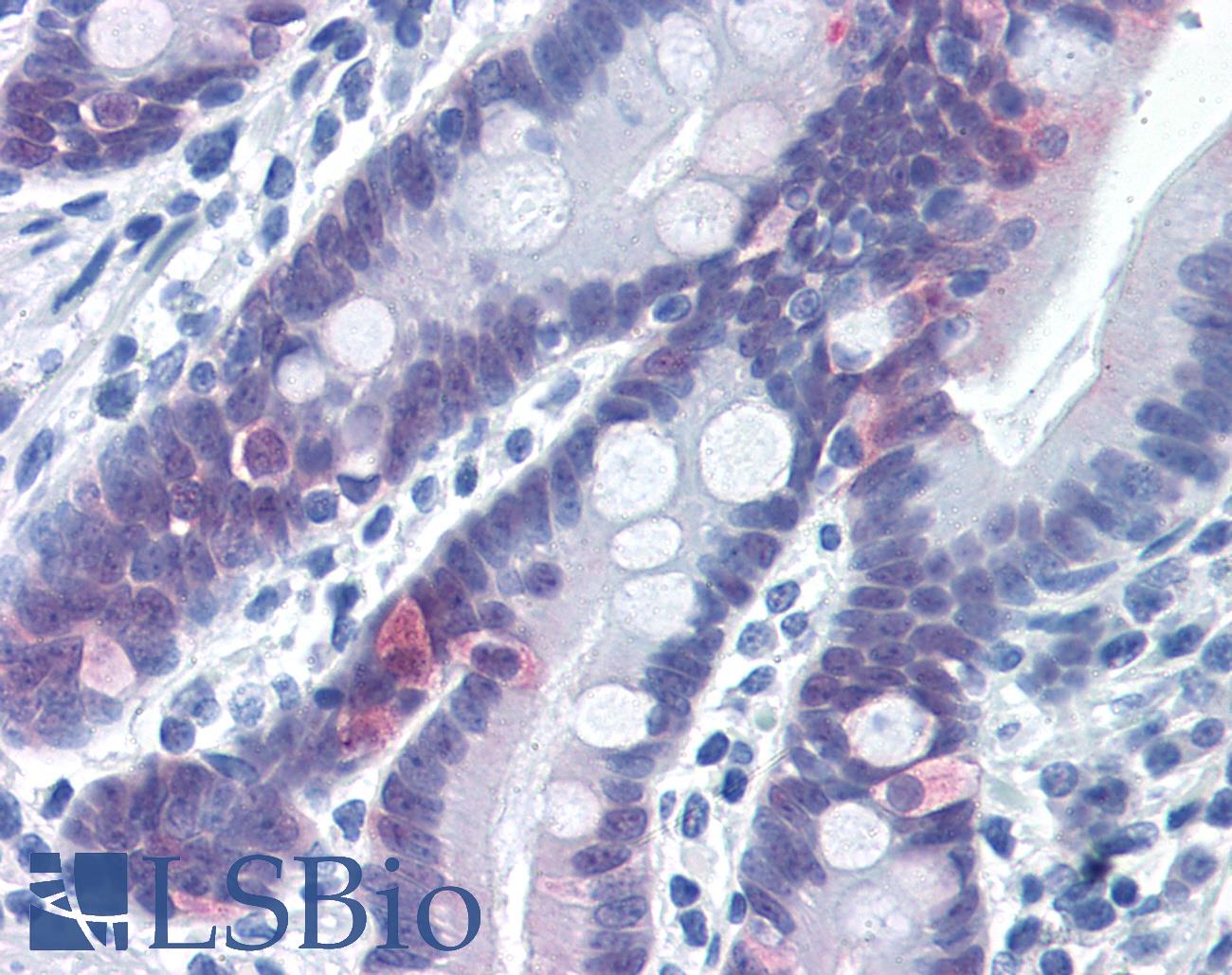 CASP6 / Caspase 6 Antibody - Anti-Caspase 6 antibody IHC of human small intestine. Immunohistochemistry of formalin-fixed, paraffin-embedded tissue after heat-induced antigen retrieval. Antibody concentration 5 ug/ml.