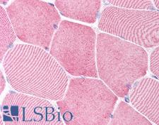 CASP6 / Caspase 6 Antibody - Anti-Caspase 6 antibody IHC of human skeletal muscle. Immunohistochemistry of formalin-fixed, paraffin-embedded tissue after heat-induced antigen retrieval. Antibody concentration 5 ug/ml.