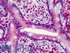 CASP7 / Caspase 7 Antibody - Anti-Caspase 7 antibody IHC of human small intestine. Immunohistochemistry of formalin-fixed, paraffin-embedded tissue after heat-induced antigen retrieval. Antibody concentration 10 ug/ml.