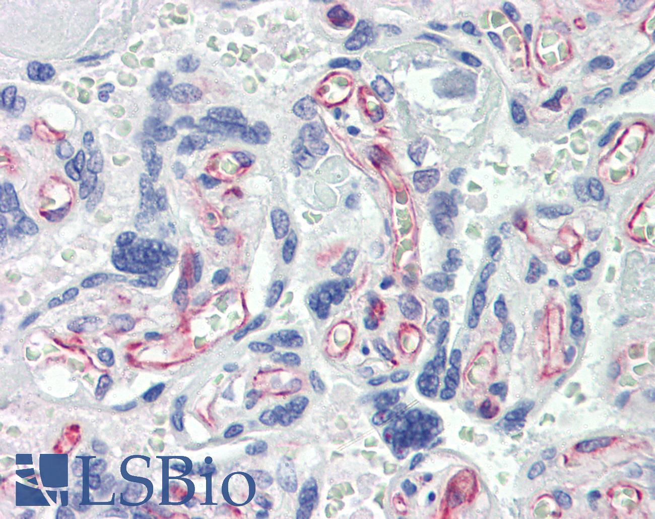 CASP7 / Caspase 7 Antibody - Anti-Caspase 7 antibody IHC of human placenta. Immunohistochemistry of formalin-fixed, paraffin-embedded tissue after heat-induced antigen retrieval. Antibody concentration 10 ug/ml.