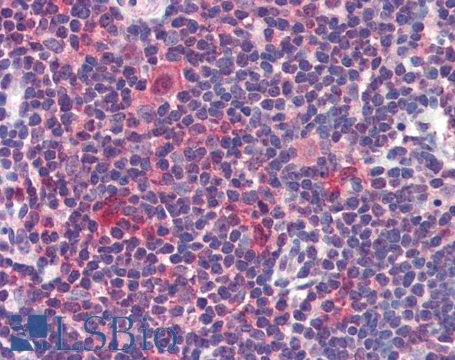 CASP7 / Caspase 7 Antibody - Anti-Caspase 7 antibody IHC of human thymus. Immunohistochemistry of formalin-fixed, paraffin-embedded tissue after heat-induced antigen retrieval. Antibody concentration 5 ug/ml.