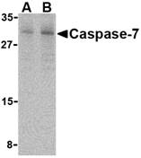 CASP7 / Caspase 7 Antibody - Western blot of caspase-7 in human skeletal muscle cell lysate with caspase-7 antibody at (A) 0.5 and (B) 1 ug/ml.