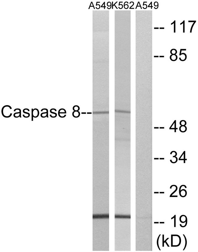 CASP8 / Caspase 8 Antibody - Western blot analysis of lysates from A549/K562, using Caspase 8 Antibody. The lane on the right is blocked with the synthesized peptide.
