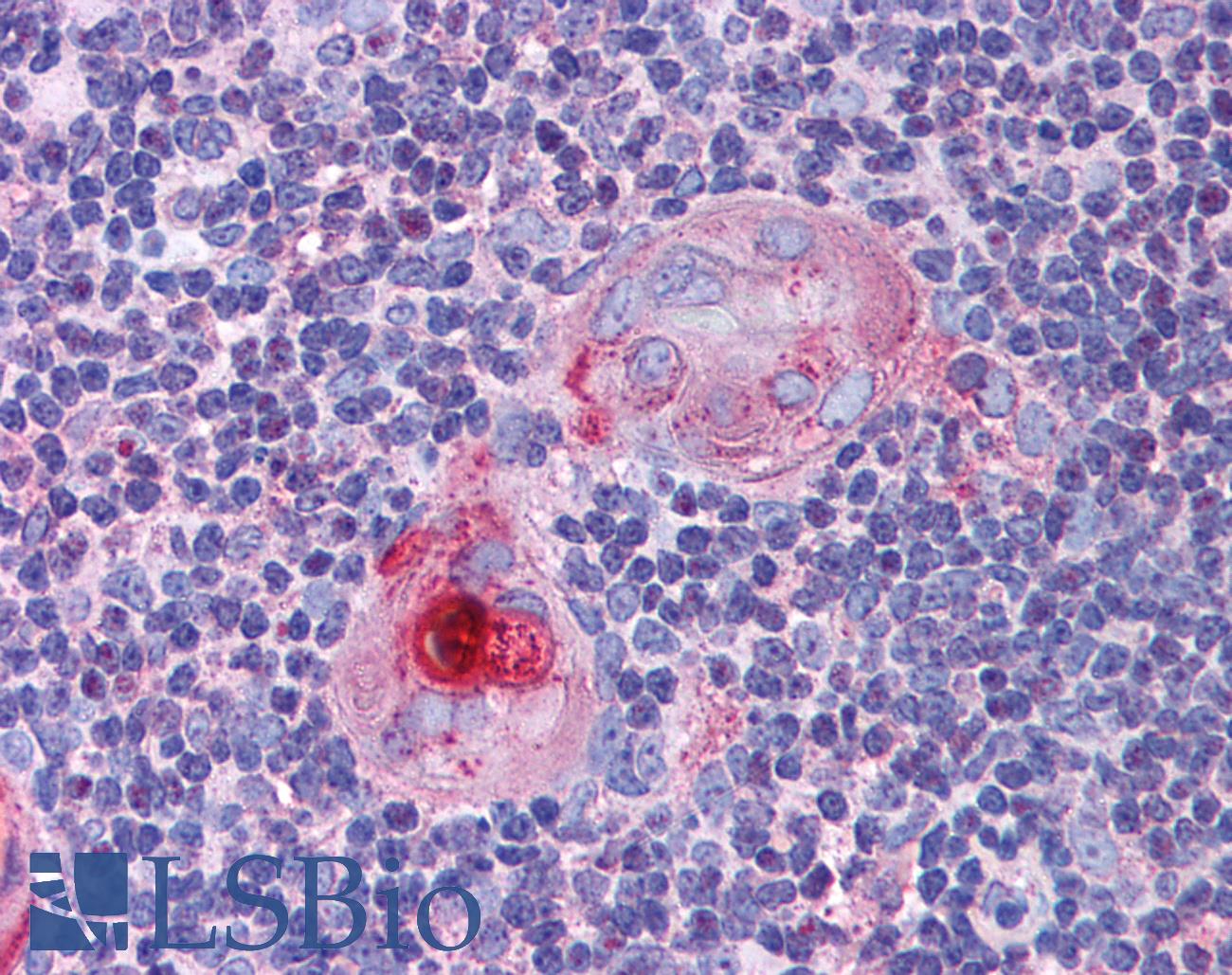 CASP8 / Caspase 8 Antibody - Anti-Caspase 8 antibody IHC of human thymus. Immunohistochemistry of formalin-fixed, paraffin-embedded tissue after heat-induced antigen retrieval. Antibody dilution 1:50.