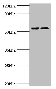CASP8 / Caspase 8 Antibody - Western blot All lanes: Caspase-8 antibody at 2µg/ml Lane 1: ACCM whole cell lysate Lane 2: LO2 whole cell lysate Secondary Goat polyclonal to rabbit IgG at 1/10000 dilution Predicted band size: 56, 54, 46, 58, 28, 26, 33, 31, 62 kDa Observed band size: 56 kDa