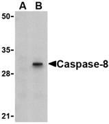 CASP8 / Caspase 8 Antibody - Western blot of Caspase-8 in HT-29 cell lysate with caspase-8 antibody at 1 ug/ml in (A) the presence or (B) the absence of blocking peptide.