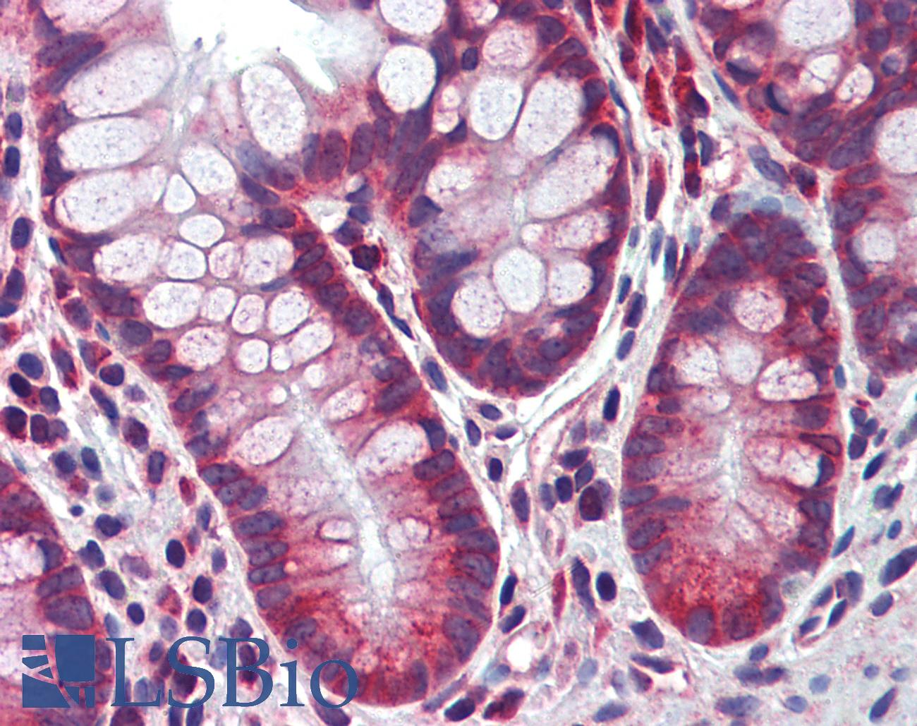 CASP8 / Caspase 8 Antibody - Anti-Caspase 8 antibody IHC of human small intestine. Immunohistochemistry of formalin-fixed, paraffin-embedded tissue after heat-induced antigen retrieval. Antibody concentration 5 ug/ml.