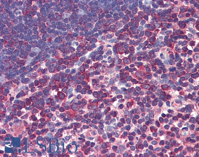 CASP8 / Caspase 8 Antibody - Anti-Caspase 8 antibody IHC of human thymus. Immunohistochemistry of formalin-fixed, paraffin-embedded tissue after heat-induced antigen retrieval. Antibody concentration 5 ug/ml.