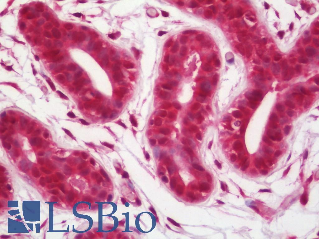 CASP9 / Caspase 9 Antibody - Human Breast: Formalin-Fixed, Paraffin-Embedded (FFPE)