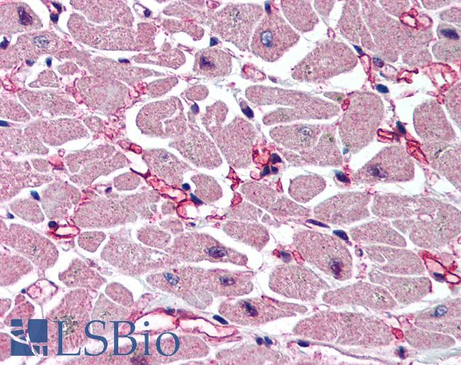 CASP9 / Caspase 9 Antibody - Anti-Caspase 9 antibody IHC of human heart. Immunohistochemistry of formalin-fixed, paraffin-embedded tissue after heat-induced antigen retrieval. Antibody concentration 5 ug/ml.