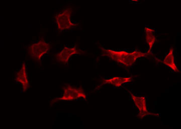 CASP9 / Caspase 9 Antibody - Staining HeLa cells by IF/ICC. The samples were fixed with PFA and permeabilized in 0.1% Triton X-100, then blocked in 10% serum for 45 min at 25°C. The primary antibody was diluted at 1:200 and incubated with the sample for 1 hour at 37°C. An Alexa Fluor 594 conjugated goat anti-rabbit IgG (H+L) Ab, diluted at 1/600, was used as the secondary antibody.